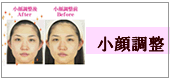 小顔調整